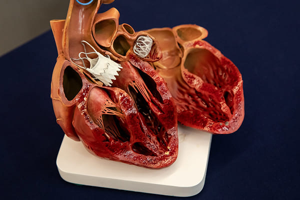 Fábrica de válvulas cardíacas amplia operações em Contagem