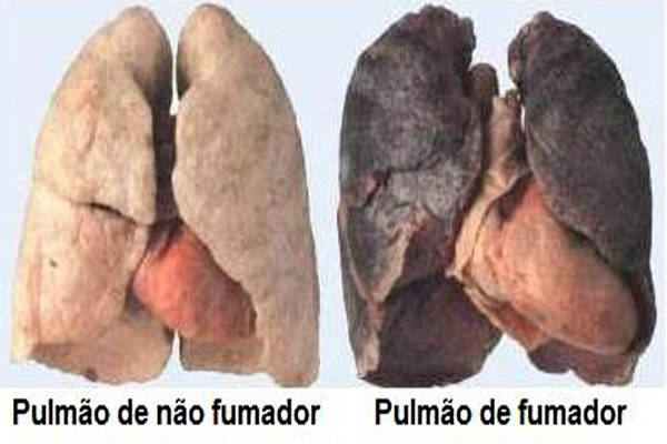 Humanizar Brasil inaugura programa destinado aos fumantes