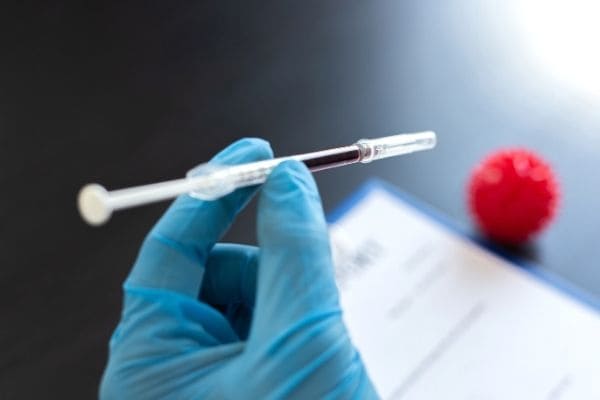 Vacinação contra Covid-19 pode começar em fevereiro, diz Pazuello