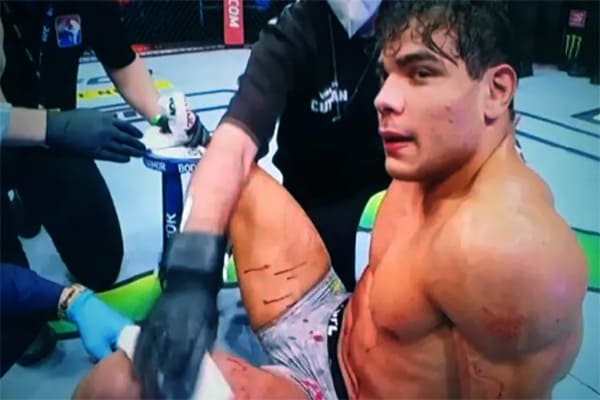 Borrachinha, lutador de MMA, acusado de agredir enfermeira durante suposta vacinação
