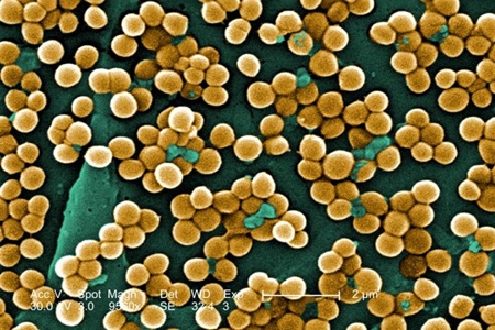 Staphylococcus aureus e o risco de infecção