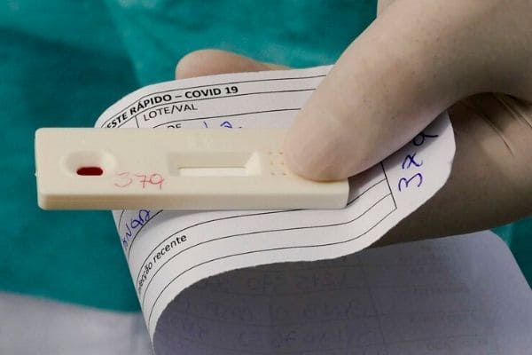 Primeiro caso de reinfecção por Covid-19 é confirmado no país