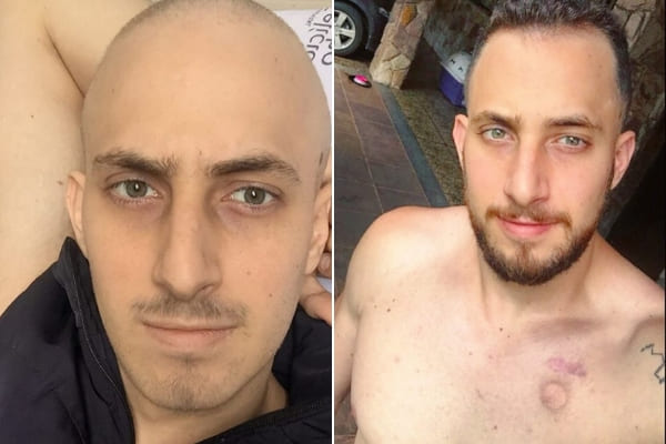 Morador de Contagem pede ajuda para transplante de medula