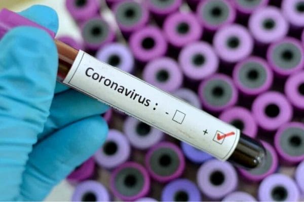 Contagem tem centenas de casos ativos de Covid-19 em acompanhamento