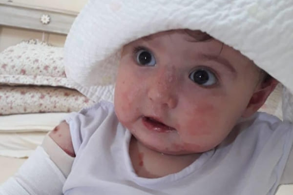 Evento arrecada dinheiro para tratamento de bebê de 9 meses