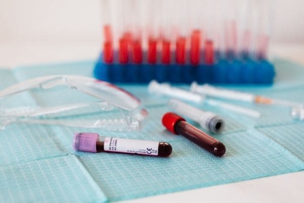 Covid-19: 306 pacientes são acompanhados em Contagem