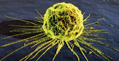 Cientistas desenvolvem vírus que ataca células cancerígenas