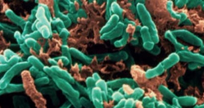 Com avanços do Brasil e China, tuberculose cai no mundo inteiro