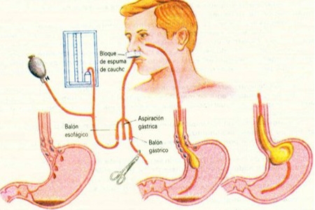 Nutrição Enteral em Domicílio